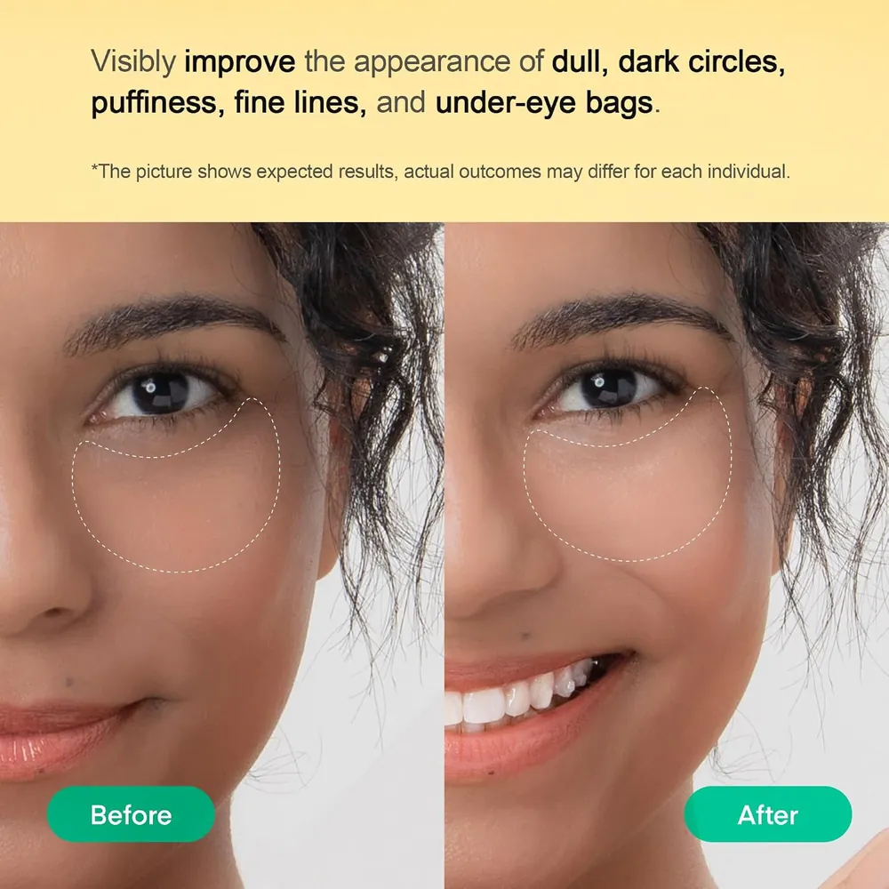 Vitamin C Eye Patches & Men’s Face Cream Duo — Know your selected set